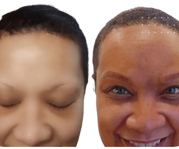 combo brows before and after